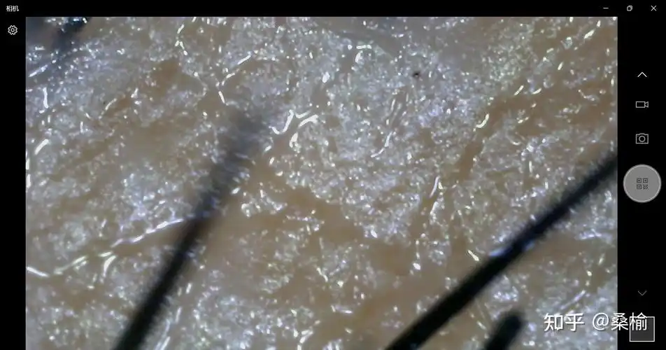 油性头皮究竟是什么样看看检测仪下的头皮就知道了