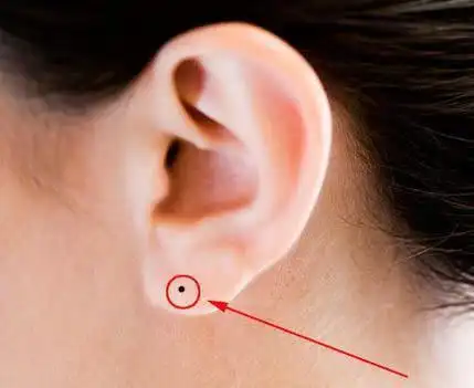 1,耳垂之痣,不只富贵,晚年运也极好