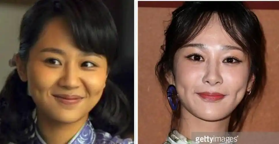 看图,大家觉得杨紫有没有做颧弓内推