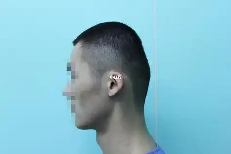 那么为什么会有些人的后脑勺是扁平的?