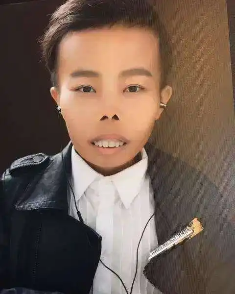 丑陋,身材矮小,还患有地中海贫血症,就靠着自己奇葩的长相取悦用户