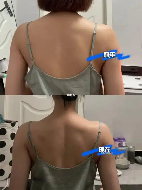 这种斜方肌怎么练能改善