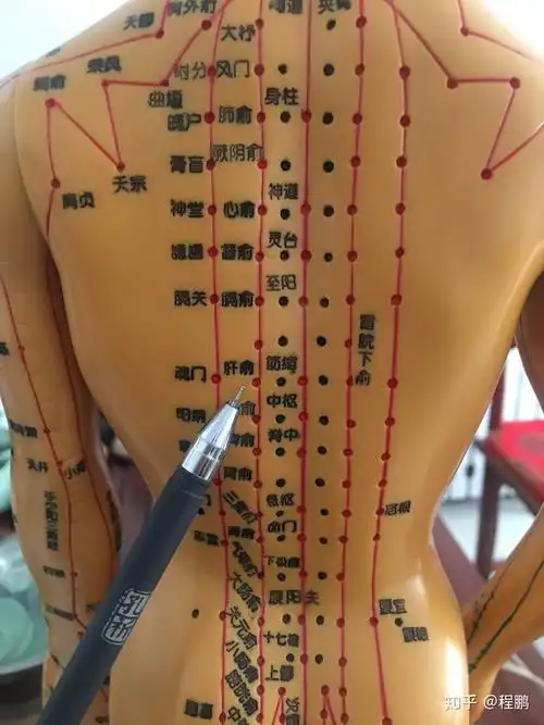 拔罐调理病症之痛经