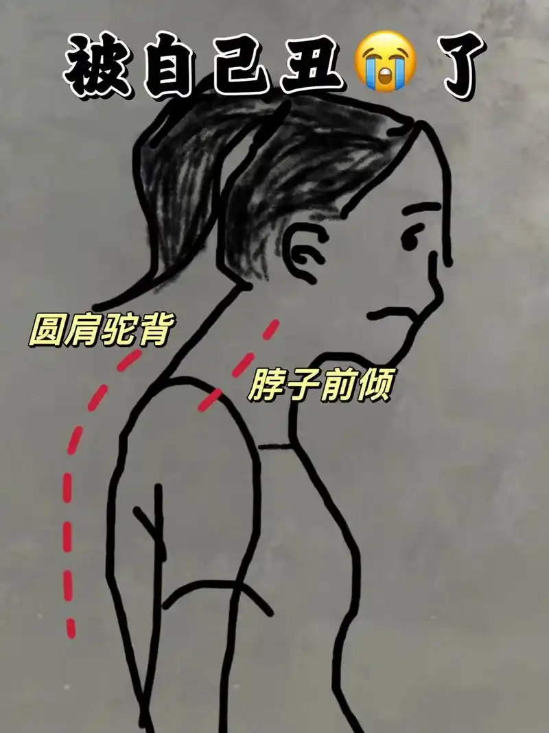 圆肩驼背脖子前倾,真的很像大妈!太羡慕别人挺拔的身姿了