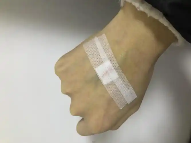 右手手背已肿,感觉血液里有五瓶药抻着我的命