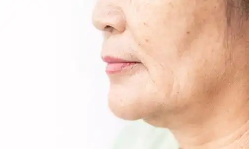 皮肤皱纹皱纹皱纹图片