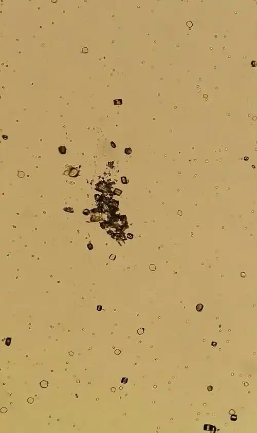 尿酸结晶#普/相差#低/高/油镜观察