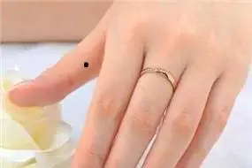 女人手指长痣的面相图解,手臂长痣的面相图解