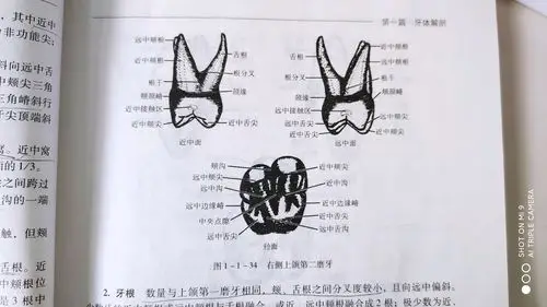 右侧上颌第二磨牙