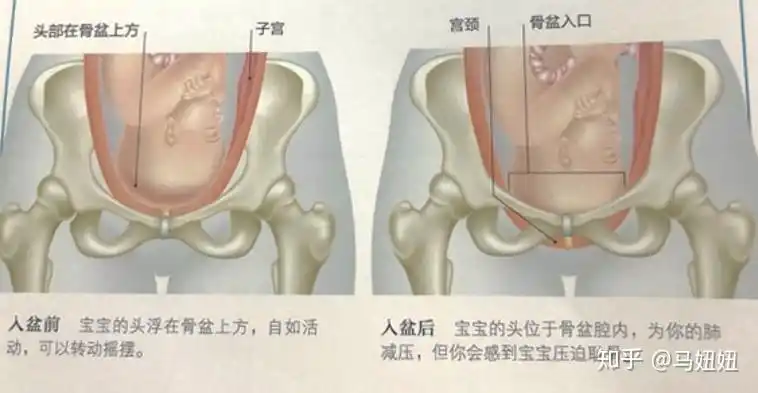 产程科普破水见红宫缩入盆我什么时候该去医院待产