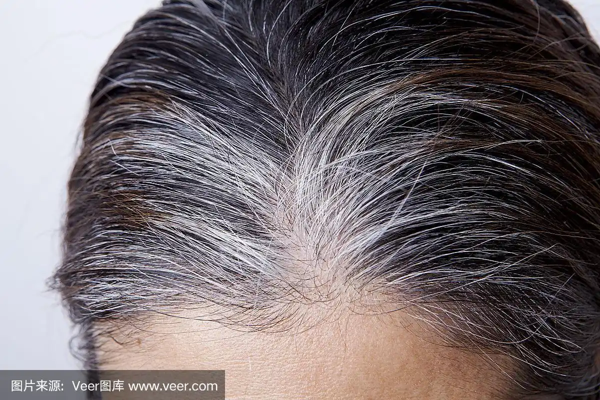 有白发问题的年轻女子