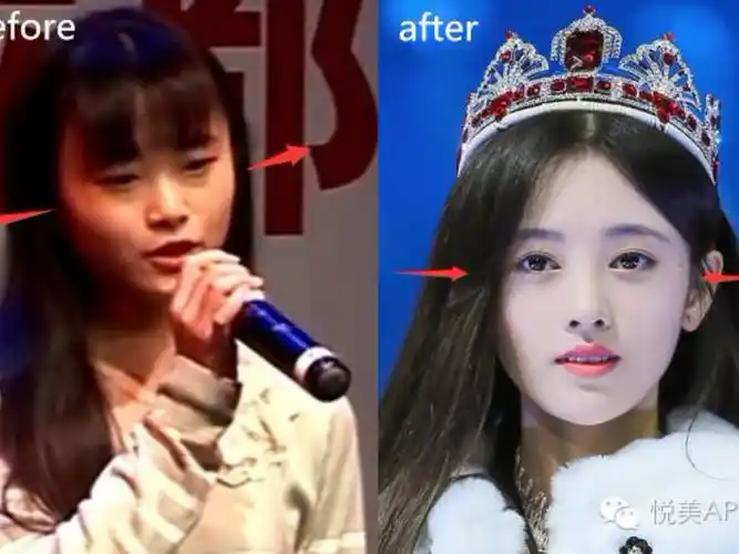 鞠婧祎整容前后对比
