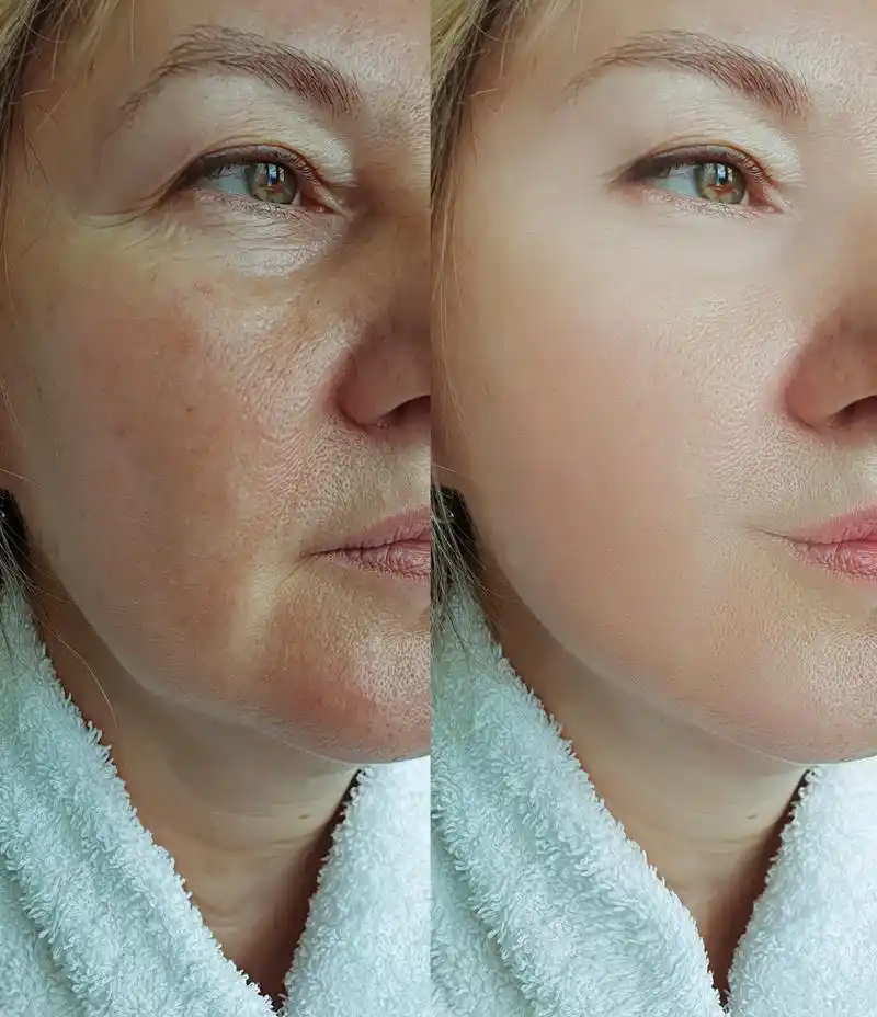 分享一个美容院绝不外传的补水方法,而且呢,成本才几块钱,用这个方法