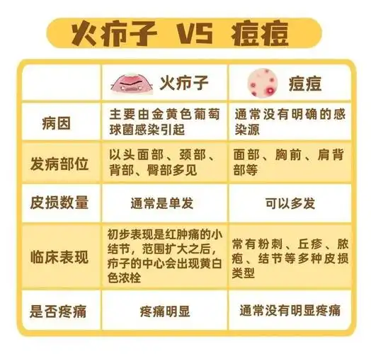 皮防科普 | 长了火疖子该怎么办?