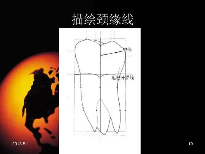 高等教育 医学 上颌第一磨牙的描绘ppt 用于上颌第一磨牙雕刻前的描绘