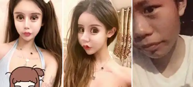 16岁女孩整容成瘾花400万整60余次后变面目全非蛇精脸