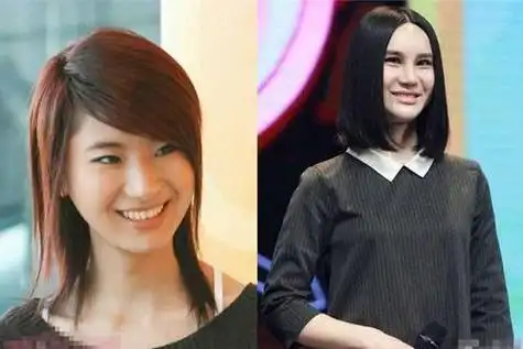 尚雯婕的脸到底怎么了为什么总挡着尚雯婕整容前后照片对比恐怖