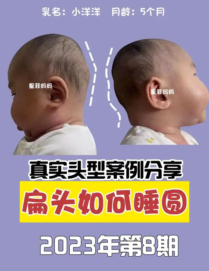 创作灵感 宝宝头型睡扁了,后脑勺饱满度不够好6015来,睡圆教