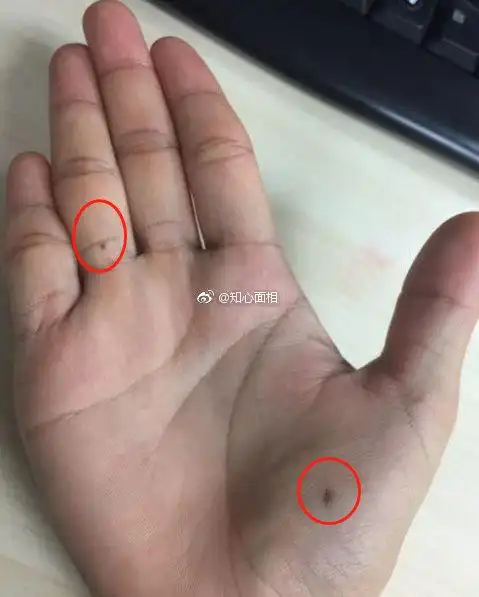 无名指上的痣,它有一个很凄美的传说,代表. 来自知心面相 - 微博