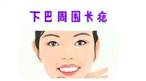 福禄痣,身体6大吉痣,命中显贵,升官发财快,中年必富