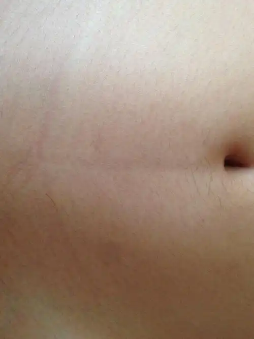 肚子上有条黑线,是怎么回事?我没生过宝宝的!