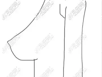 水滴形胸部照片