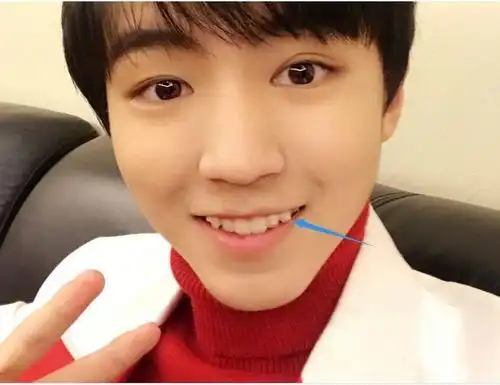 有关小虎牙的那些事儿