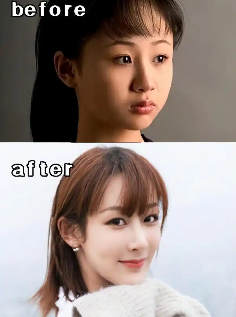 毛晓彤整容了吗