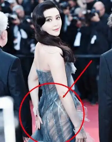 明星们的缺陷:黄轩的小手,范冰冰的臀部,她却天生没有"子宫"_网易订阅