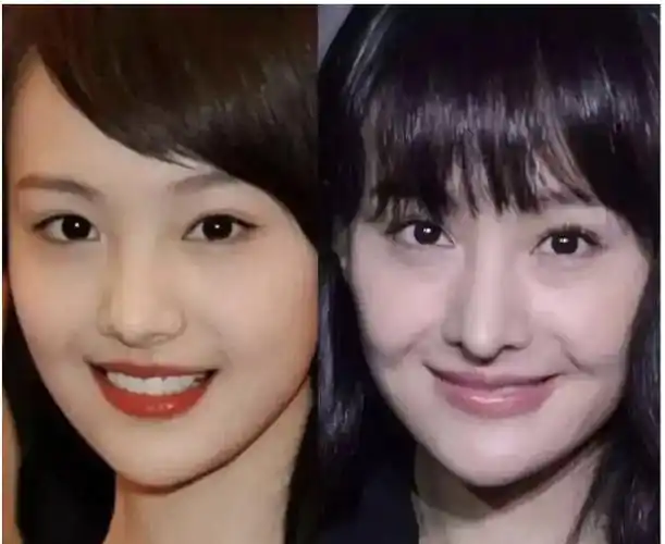 走向粗致越来越美越来越有气质,娱乐圈整容turn车的真的很多,比如郑爽