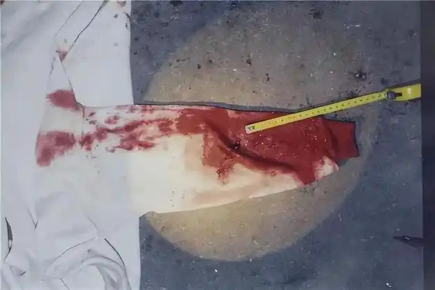 案例11岁女孩被灭门头部被砍出脑浆忍痛装死20分钟后报警破案