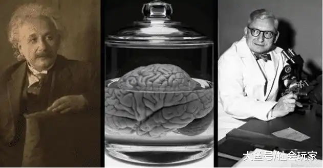 爱因斯坦去世后,大脑被人分成240块切片,研究发现与常人不同!
