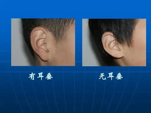 《相貌各异的我们》课件ppt