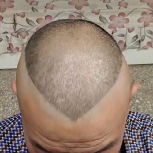 郭德纲成人理发模具同款头型大人发型郭德纲桃心短发剃头辅助神器