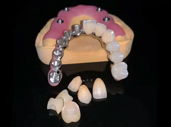 纯钛桥架-纯钛桥架-淄博百合义齿有限公司是一家综合型定制式义齿加工