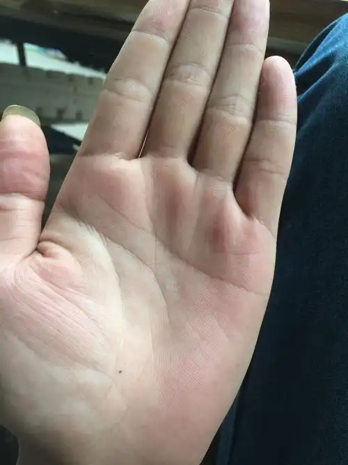 掌心痣. 有什么说法么? 可以帮忙看看这个痣有什么讲究吗?