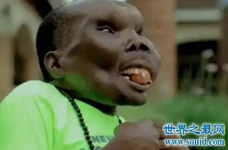 世界上最丑的男人是他,一个乌干达人,在世界上是最丑的,但是人家靠脸