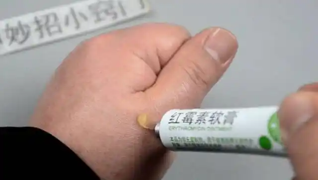 2块钱一个的红霉素软膏被称为淡斑专家医生道出用法和答案