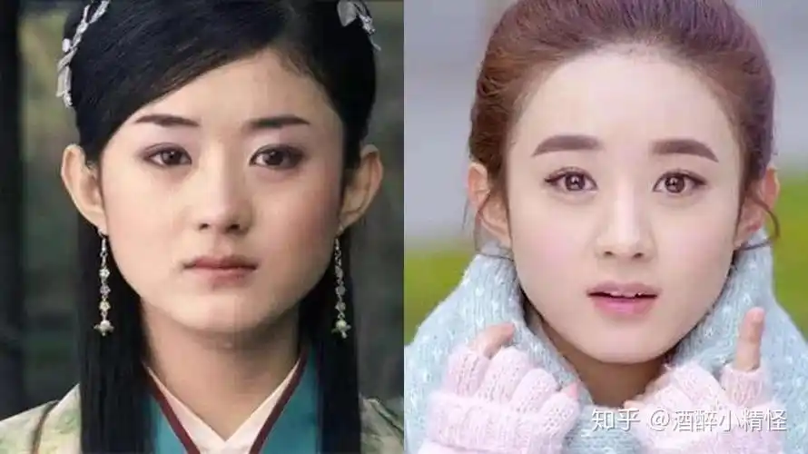 为什么几乎没有人按照赵丽颖的样子整容