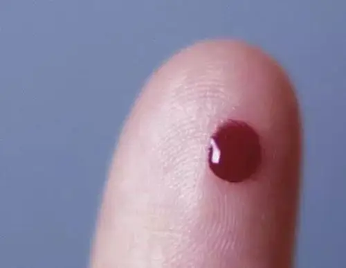 一滴血就能检测癌症?真相是这样.丨藏文科普