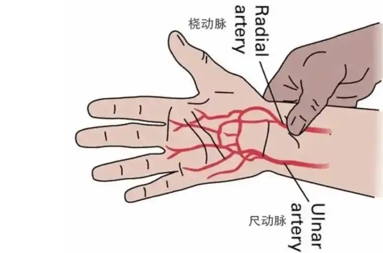 尺动脉和桡动脉只有将正中动脉变成尺动脉和桡动脉,才是正常身体里面