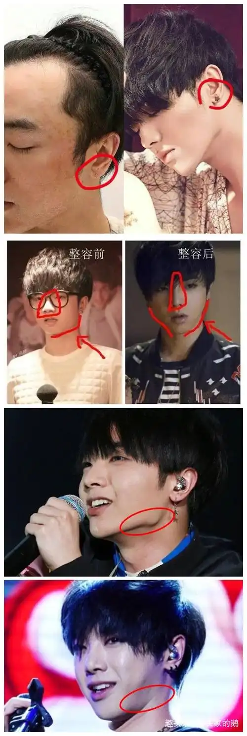 明星承认整容有这么难吗华晨宇被曝整容后团队发文否认造谣