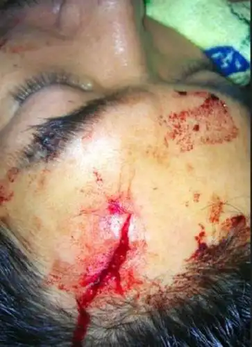 他与陆毅是同班同学,拍戏被撞伤满脸是血差点毁容,如今依旧帅气