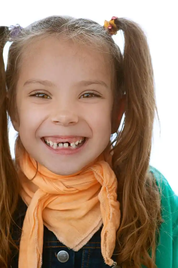 没牙的小女孩,美丽无牙小女孩笑得快活密切起来.