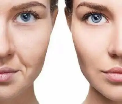 面部松弛下垂怎么做轻医美(面部松弛下垂怎么做轻医美手术)