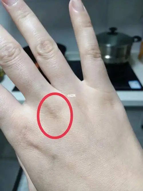 手背中指最下关节处