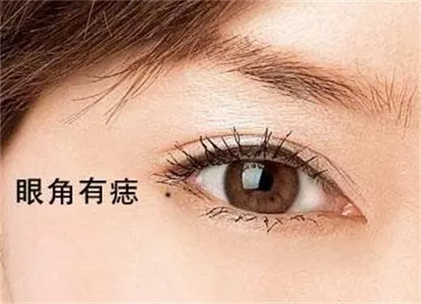 女人左眼角有痣代表什么左眼角下方长痣的女人好不好
