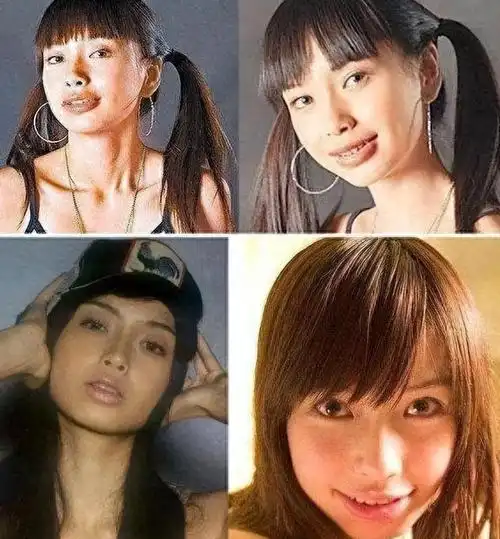 02杨颖——龅牙变女神