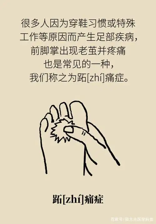 前脚掌有老茧,一踩地就疼?这可不是一层死皮那么简单