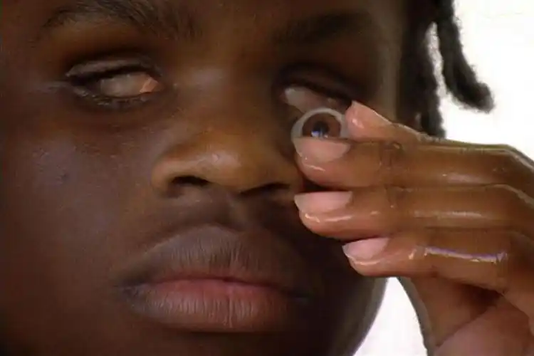 和海豚一样靠回声定位的男孩:抠掉眼珠也能看见